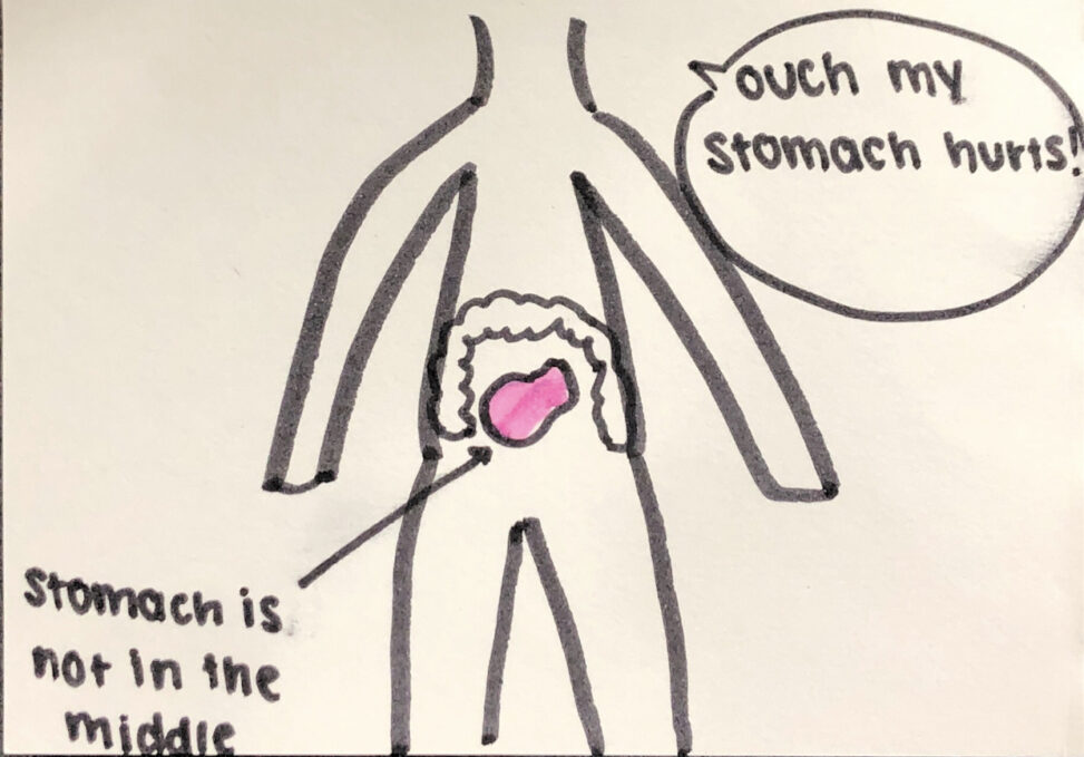 A human anatomy figure and in the abdominal area the stomach is in the centre while the large intestine surrounds it. In the speed bubble says “ouch my stomach hurts!”.